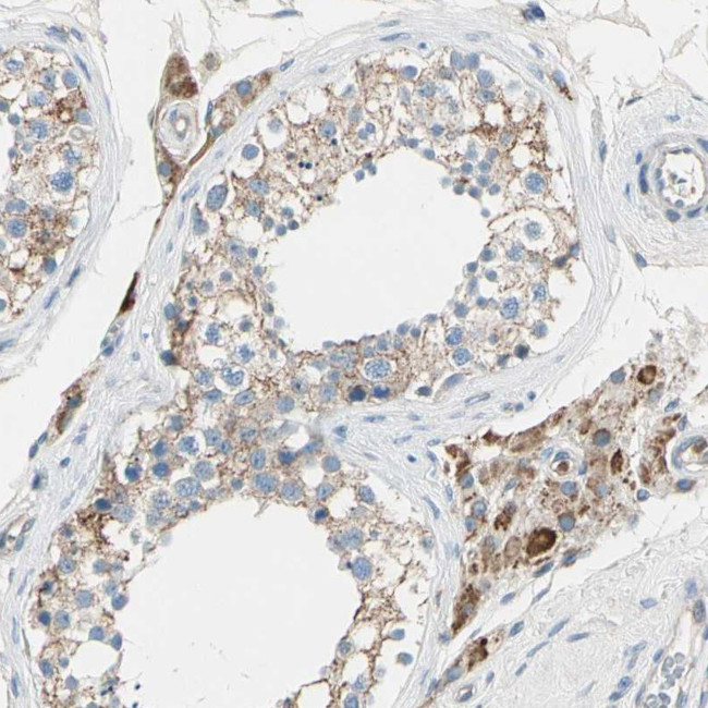 LY6G6F Antibody in Immunohistochemistry (Paraffin) (IHC (P))