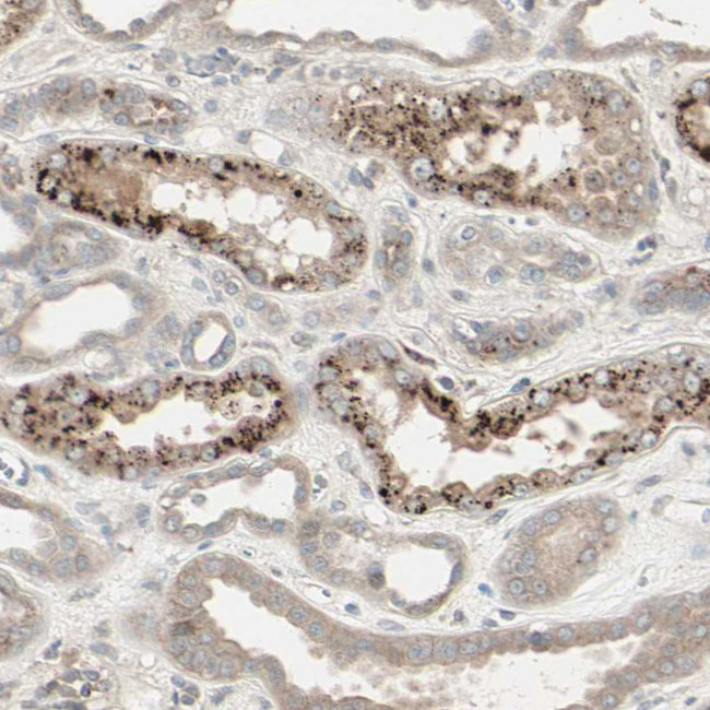 CALCRL Antibody in Immunohistochemistry (Paraffin) (IHC (P))