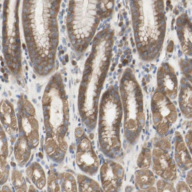 TTMP Antibody in Immunohistochemistry (IHC)
