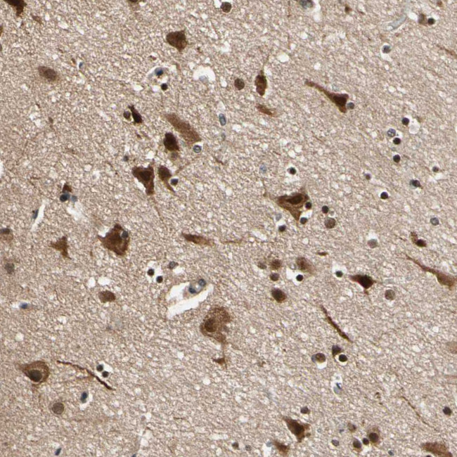NGEF Antibody in Immunohistochemistry (Paraffin) (IHC (P))