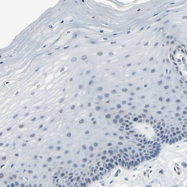 PSMA2 Antibody in Immunohistochemistry (Paraffin) (IHC (P))
