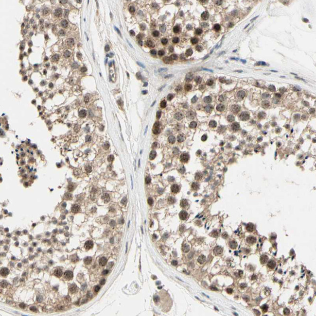 MCPH1 Antibody in Immunohistochemistry (Paraffin) (IHC (P))