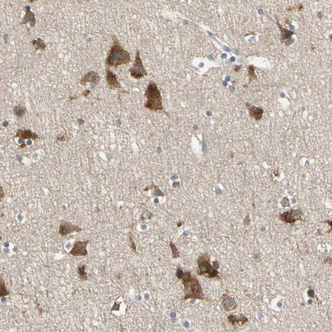 CGREF1 Antibody in Immunohistochemistry (Paraffin) (IHC (P))
