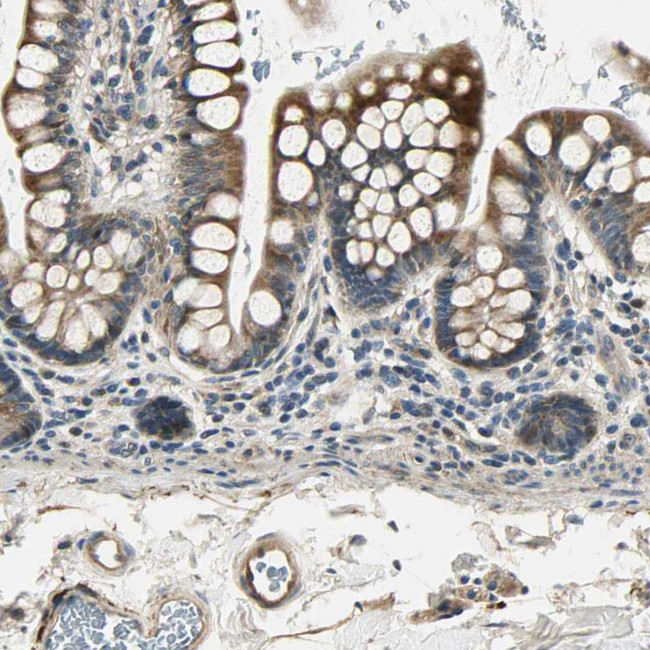 LPGAT1 Antibody in Immunohistochemistry (IHC)