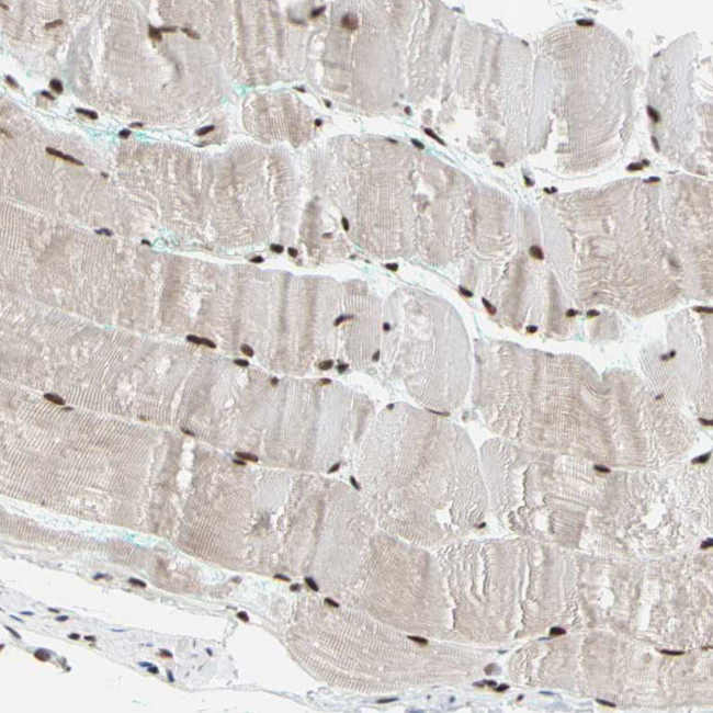 FAM98B Antibody in Immunohistochemistry (Paraffin) (IHC (P))