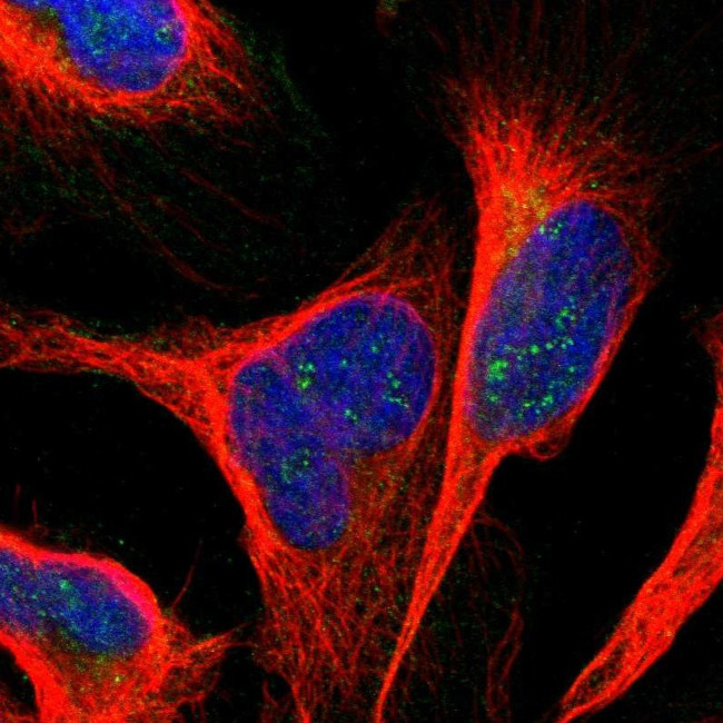ANKS6 Antibody in Immunocytochemistry (ICC/IF)