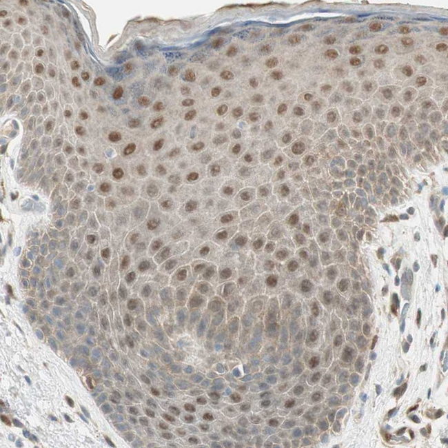 LTA4H Antibody in Immunohistochemistry (Paraffin) (IHC (P))