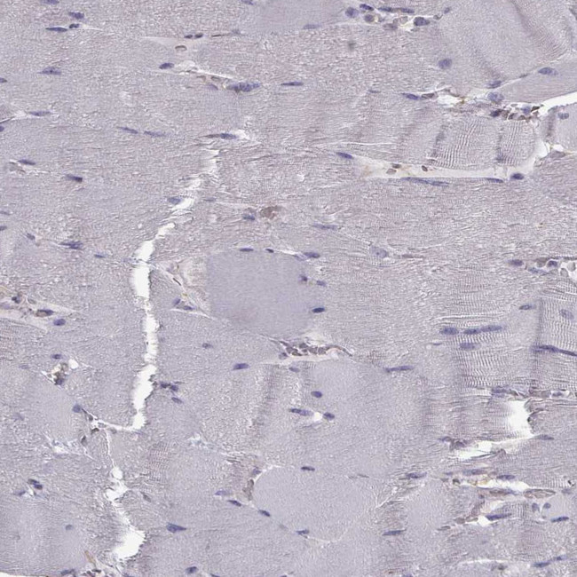 QPCT Antibody in Immunohistochemistry (Paraffin) (IHC (P))