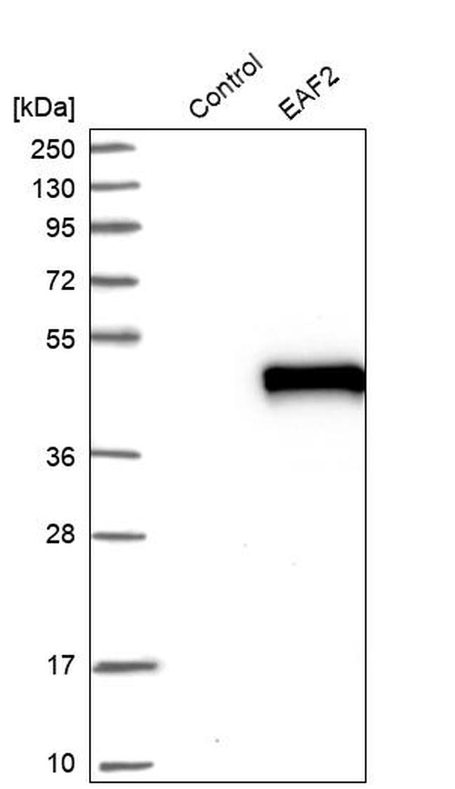 EAF2 Antibody in Western Blot (WB)