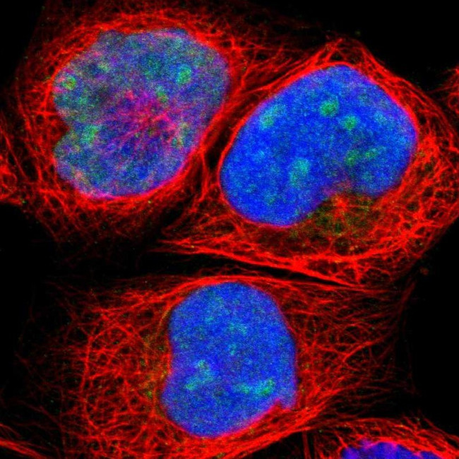 HJURP Antibody in Immunocytochemistry (ICC/IF)