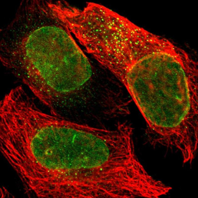 UNC84A Antibody in Immunocytochemistry (ICC/IF)