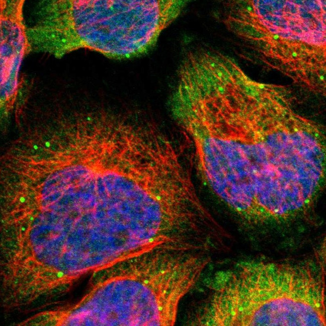 TDRP Antibody in Immunocytochemistry (ICC/IF)