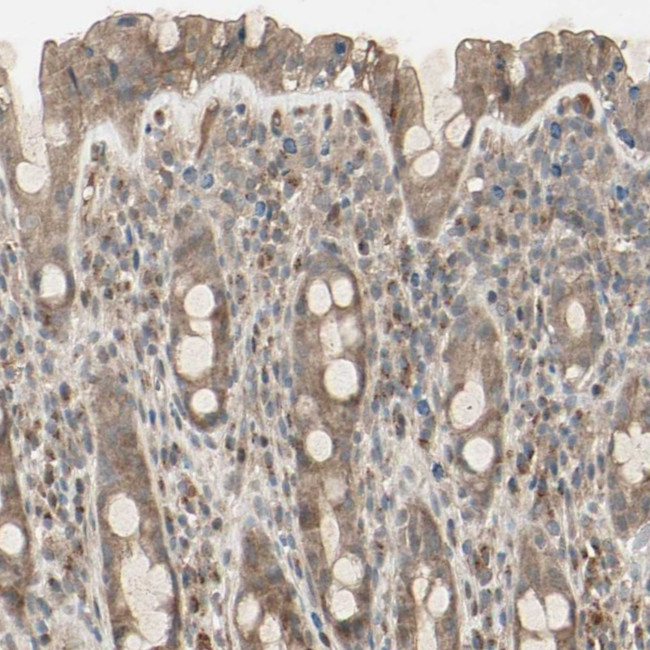 FHDC1 Antibody in Immunohistochemistry (Paraffin) (IHC (P))