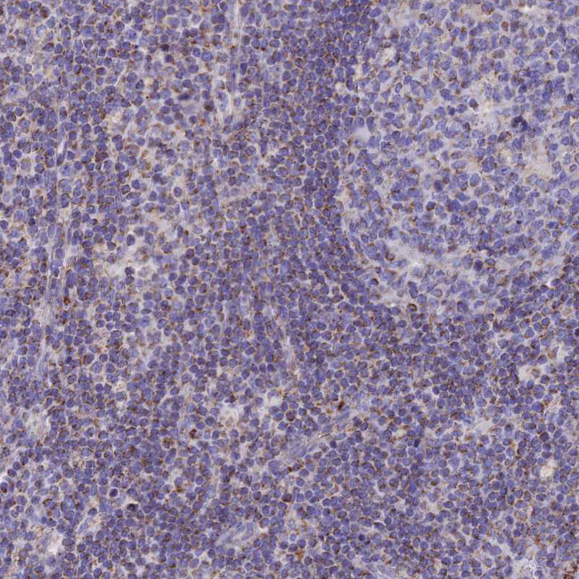 TMEM206 Antibody in Immunohistochemistry (Paraffin) (IHC (P))