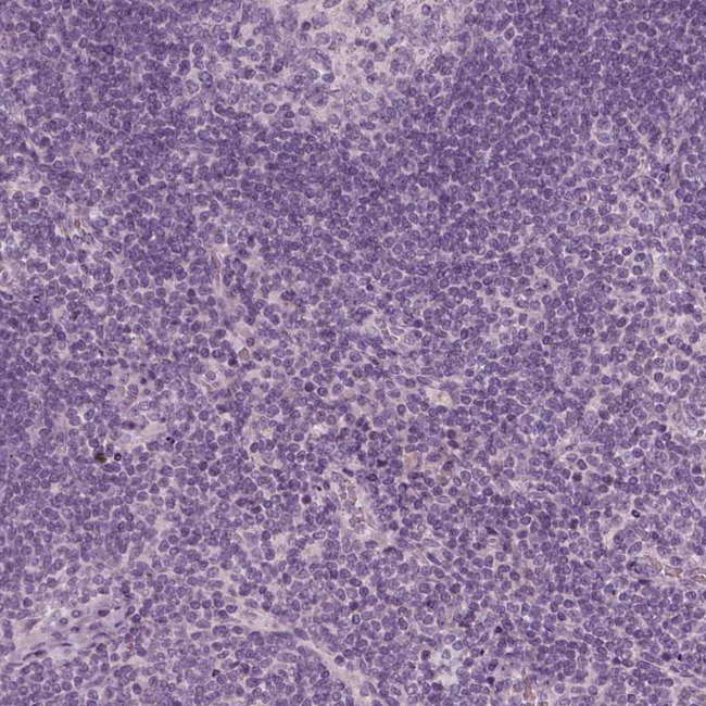 ZP4 Antibody in Immunohistochemistry (Paraffin) (IHC (P))