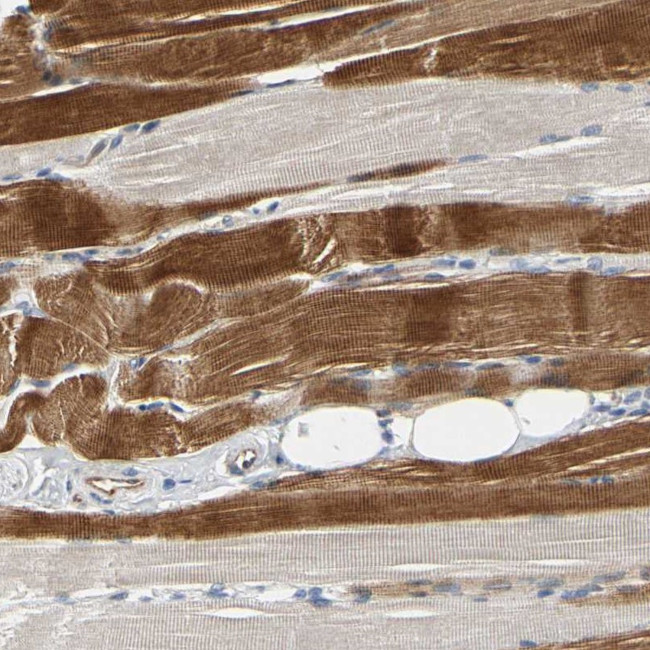 ZNF236 Antibody in Immunohistochemistry (Paraffin) (IHC (P))