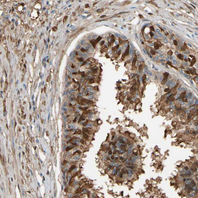 CSMD2 Antibody in Immunohistochemistry (Paraffin) (IHC (P))