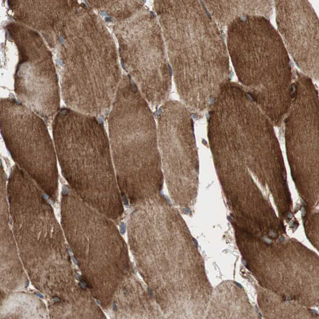 AKAP1 Antibody in Immunohistochemistry (Paraffin) (IHC (P))