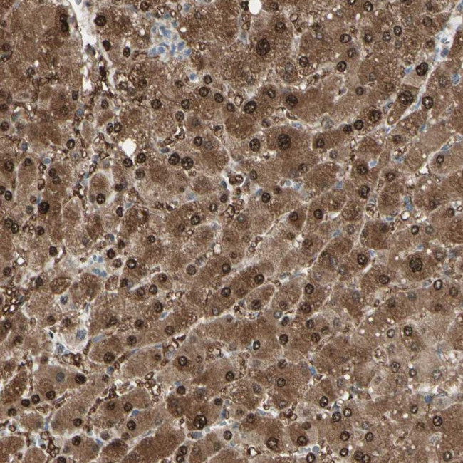 EVC Antibody in Immunohistochemistry (Paraffin) (IHC (P))
