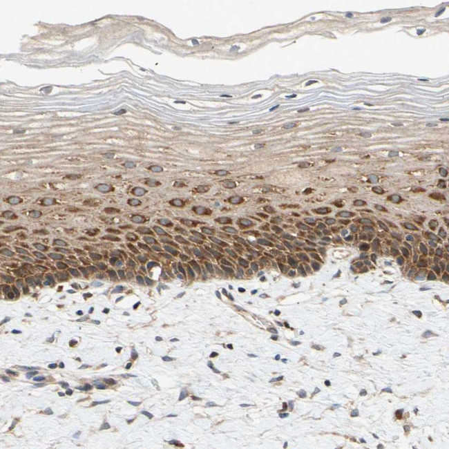 ANKHD1 Antibody in Immunohistochemistry (Paraffin) (IHC (P))