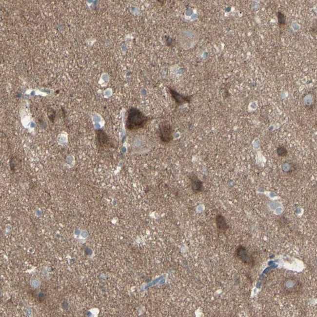 PCDHGA2 Antibody in Immunohistochemistry (IHC)
