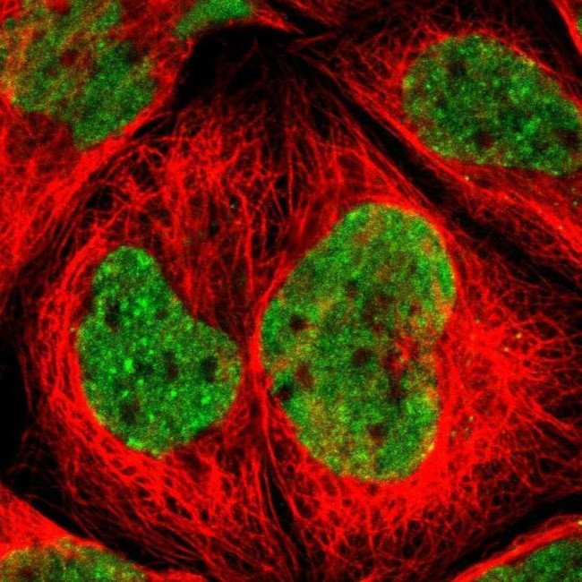 CHAMP1 Antibody in Immunocytochemistry (ICC/IF)