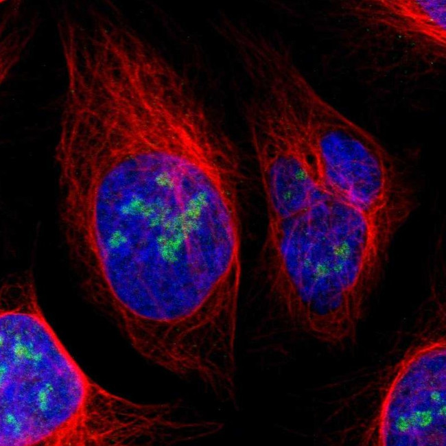 URB2 Antibody in Immunocytochemistry (ICC/IF)