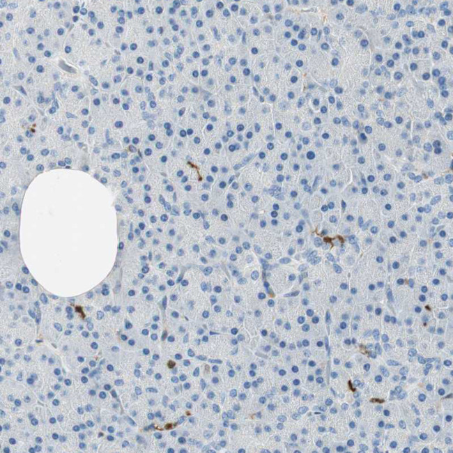 COTL1 Antibody in Immunohistochemistry (Paraffin) (IHC (P))