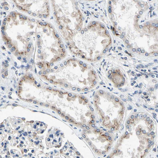 p27 Antibody in Immunohistochemistry (Paraffin) (IHC (P))
