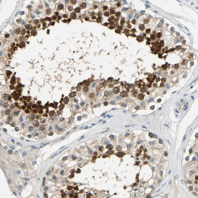 CCDC104 Antibody in Immunohistochemistry (IHC)