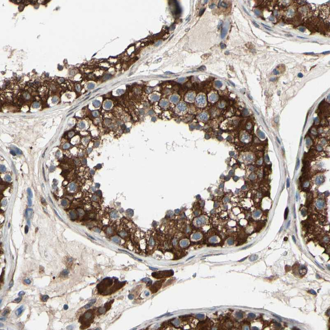 FAM213A Antibody in Immunohistochemistry (Paraffin) (IHC (P))