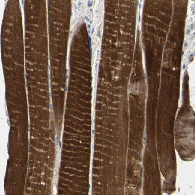 TPM3 Antibody in Immunohistochemistry (Paraffin) (IHC (P))