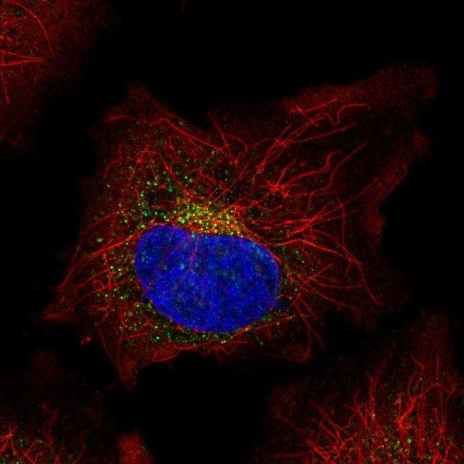 SPINK5 Antibody in Immunocytochemistry (ICC/IF)