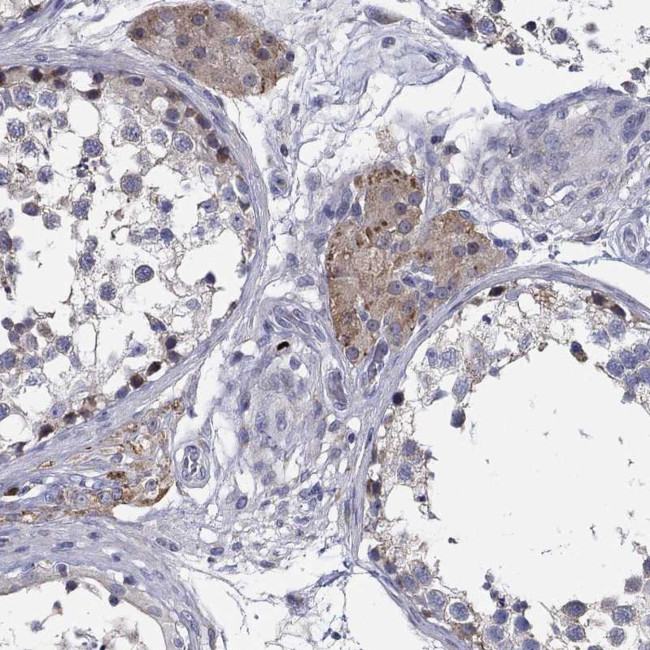 CFAP61 Antibody in Immunohistochemistry (Paraffin) (IHC (P))