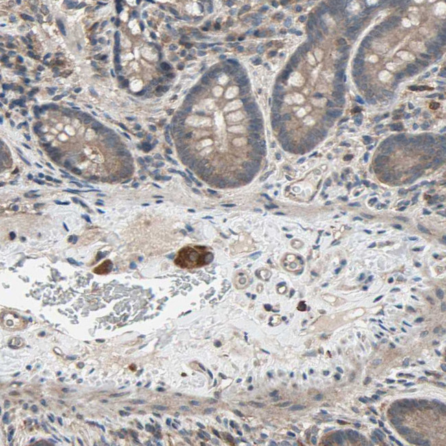 PNPLA7 Antibody in Immunohistochemistry (IHC)