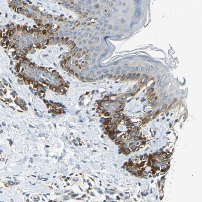 NPHP3 Antibody in Immunohistochemistry (Paraffin) (IHC (P))