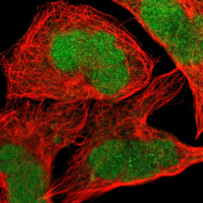 JPH1 Antibody in Immunocytochemistry (ICC/IF)