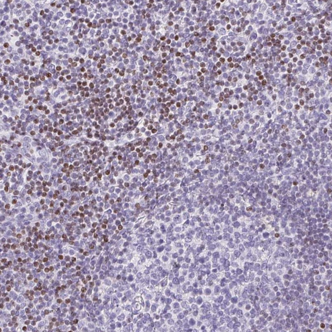 BEND2 Antibody in Immunohistochemistry (Paraffin) (IHC (P))
