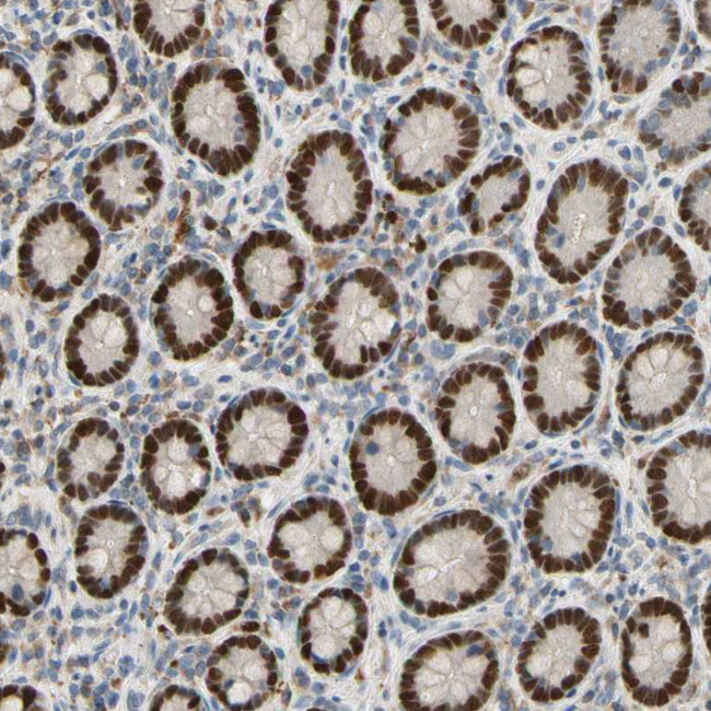 ZNF306 Antibody in Immunohistochemistry (Paraffin) (IHC (P))