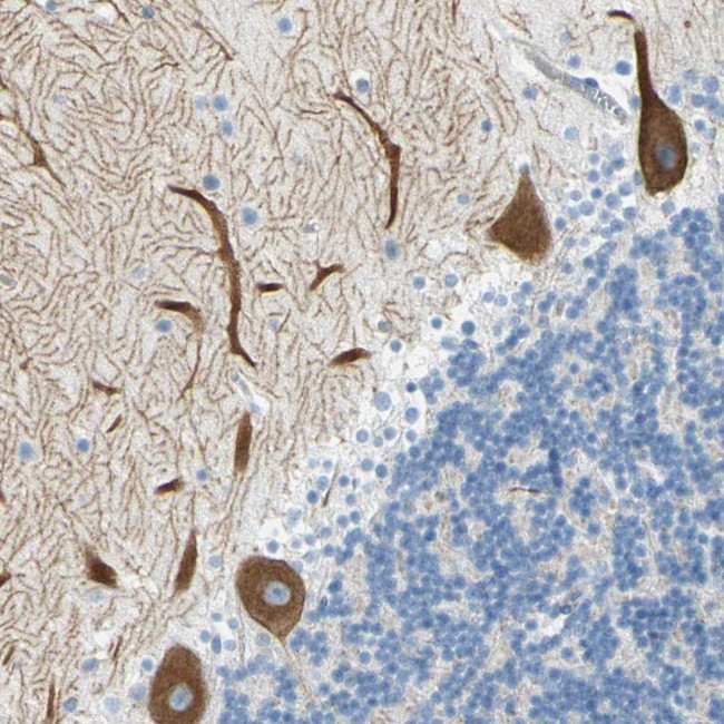 FRMD4B Antibody in Immunohistochemistry (Paraffin) (IHC (P))