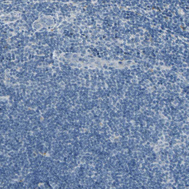 ANGPTL1 Antibody in Immunohistochemistry (IHC)