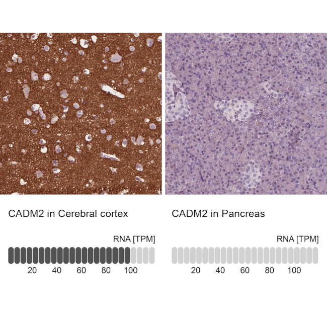 CADM2 Antibody