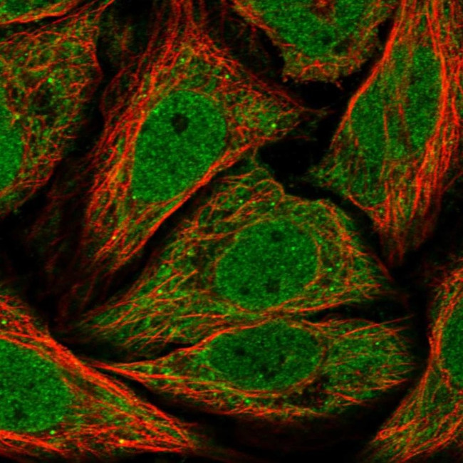 TIM17 Antibody in Immunocytochemistry (ICC/IF)