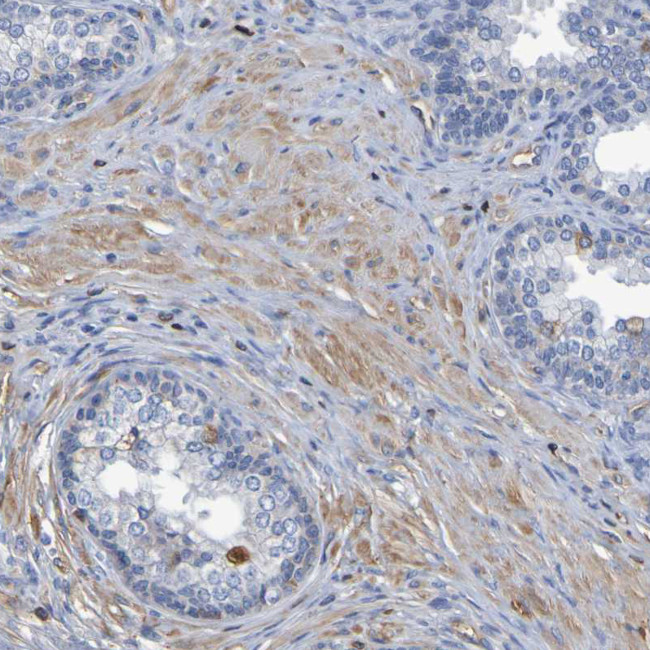 GAB3 Antibody in Immunohistochemistry (Paraffin) (IHC (P))