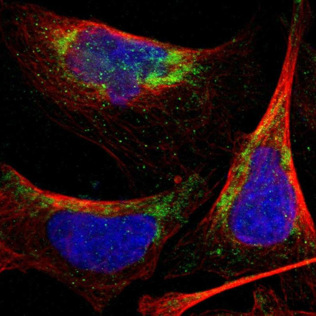 PNKD Antibody in Immunocytochemistry (ICC/IF)