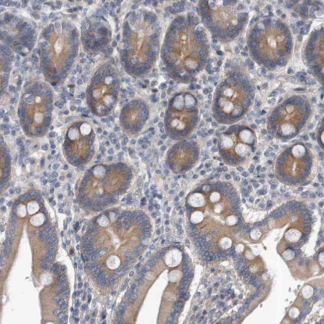 PCDH8 Antibody in Immunohistochemistry (Paraffin) (IHC (P))