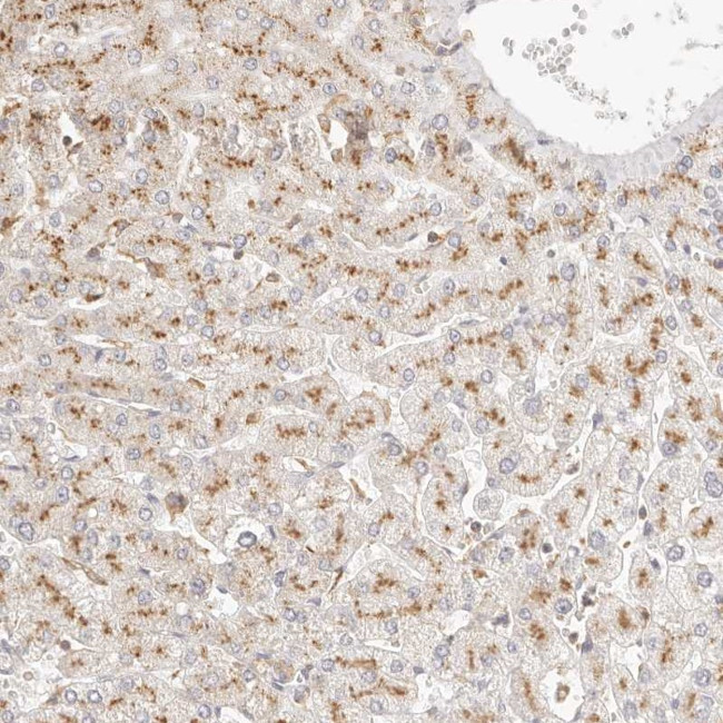 LECT1 Antibody in Immunohistochemistry (Paraffin) (IHC (P))