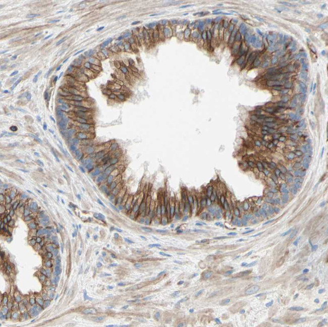 ENDOD1 Antibody in Immunohistochemistry (Paraffin) (IHC (P))
