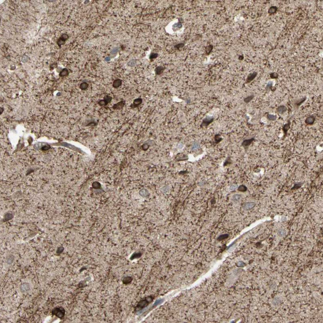 SHROOM4 Antibody in Immunohistochemistry (Paraffin) (IHC (P))