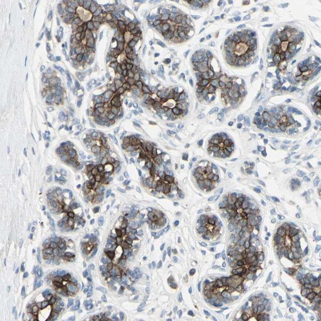 TIMM21 Antibody in Immunohistochemistry (Paraffin) (IHC (P))